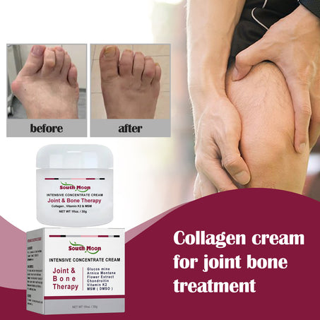 Protein Cream Soothes Joint Bone Soreness, Deformation, Correction And Repair