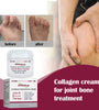 Protein Cream Soothes Joint Bone Soreness, Deformation, Correction And Repair